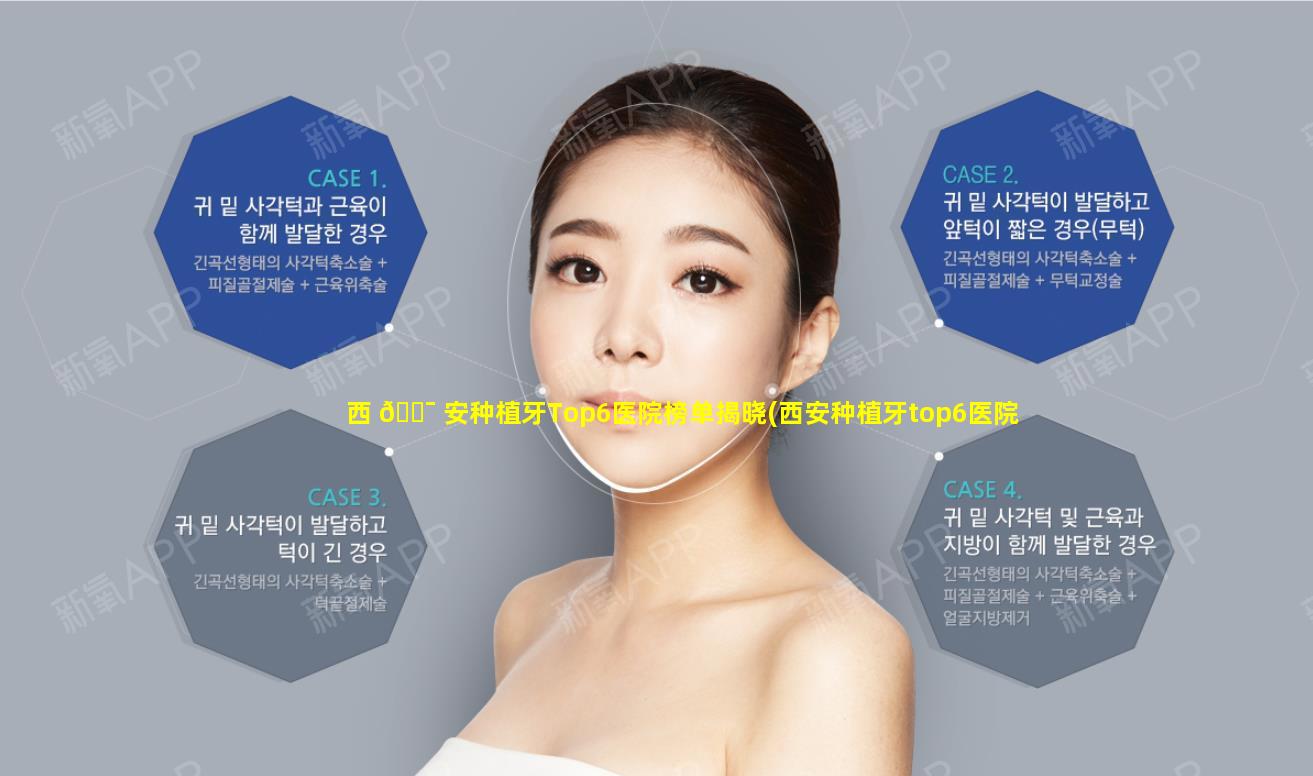 西 🐯 安种植牙Top6医院榜单揭晓(西安种植牙top6医院榜单揭晓医生)